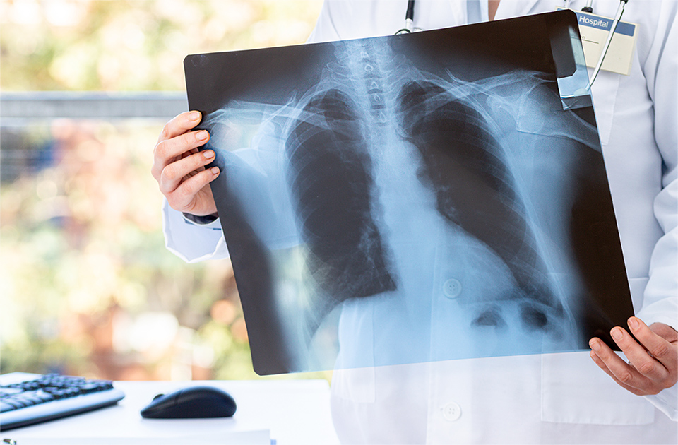 胸部X検査